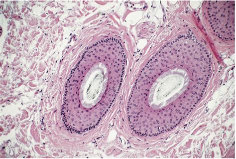 Hair follicle cross section Diagram | Quizlet