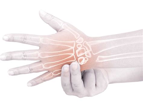 Hand Fracture - Signs, Symptoms, and Treatment - Burjeel Hospital