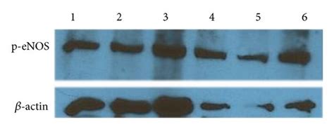 Endothelial marker expression in early and late cultured cardiac ...