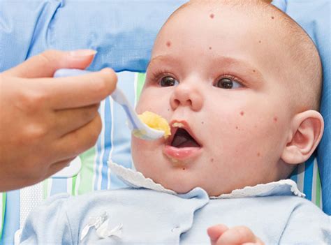 Food Allergy Symptoms in Babies and Children | Parenting How