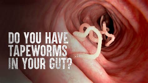 Are Dried Tapeworm Segments Harmful? Top 4 Best Answers - Chambazone.com