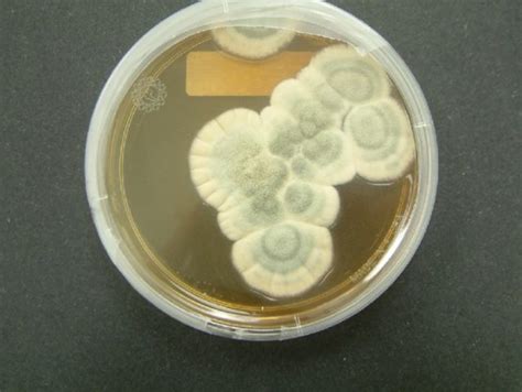 Penicillium Mold Health Effects and Removal Methods