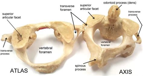 Atlas and Axis | Anatomy Corner | Human skeleton anatomy, Human body ...