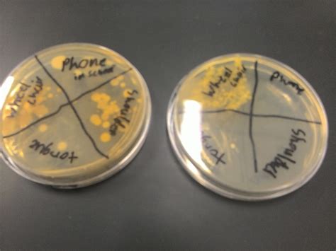 BIOL213 | PLANTS TWO: Mystery Bacteria on TSA agar plates by Robert Barker