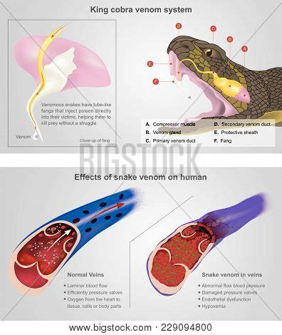 King Cobra Venom Vector & Photo (Free Trial) | Bigstock