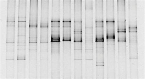 Gel Electrophoresis and DNA Fingerprinting – MHCC Biology 112: Biology ...