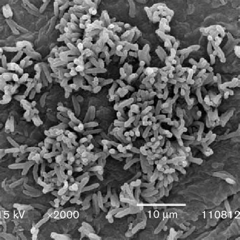 Scanning electron micrograph of sporangia and sporangiospore of strain ...