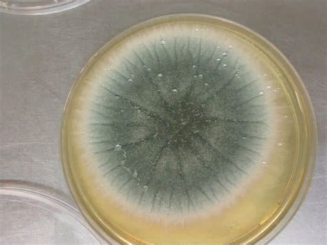 Aspergillus fumigatus - Allergy, Symptoms, & Treatment | Mold Busters