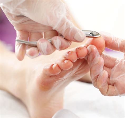 Foot Care Treatments in Ottawa | Natural Sole Wellness