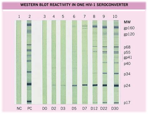 Western Blot Technique: Principle, Procedures and Uses - microbeonline