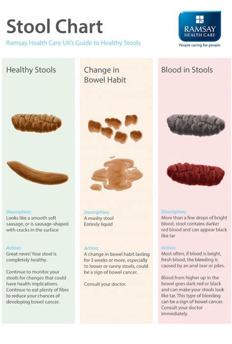 Bowel cancer symptoms: Blood in stool and red poo could be signs ...