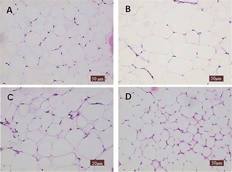 Histology of adipose tissue of mice fed the experimental diets for 15 ...