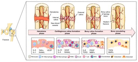 Bone Remodeling Diagram