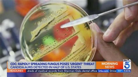 Fungal expert explains CDC’s ‘urgent’ drug-resistant fungus warning | KTLA