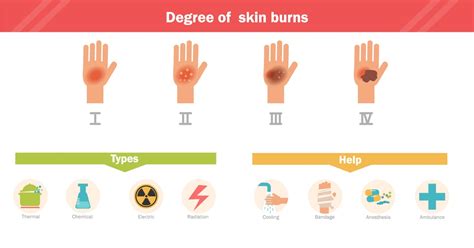 Fourth Degree Burn Diagram