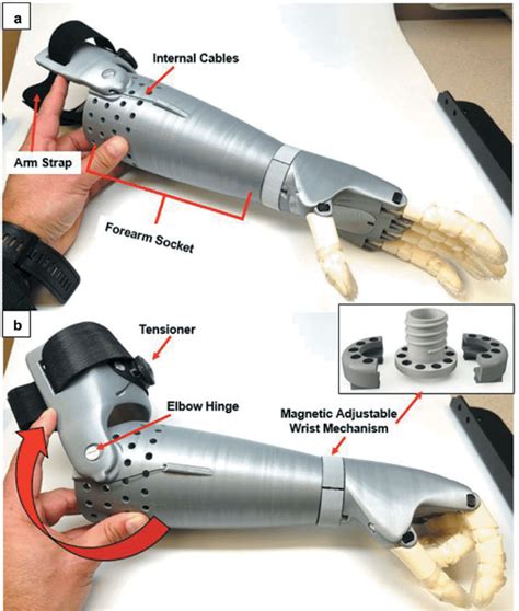 The 3D Printed arm prostheses. (a) The trans-radial arm prosthesis in ...