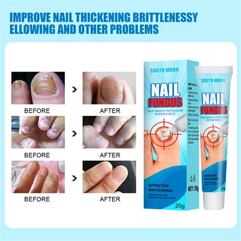 2 PACK Nail Growth And Strengthening Serum Onychomycosis Softening ...