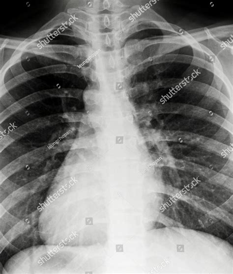 Chest xray scan Stock Photos | Creative Market