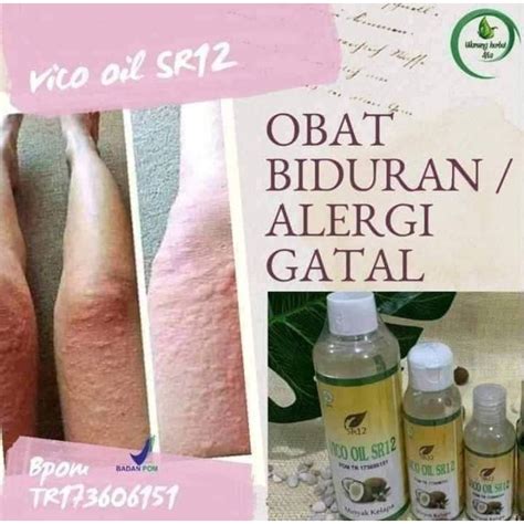 Jual OBAT GATAL BIDURAN VICO SR12 PALING AMPUH/OBAT GATAL KULIT/OBAT ...