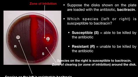 Disk Diffusion Test using Bacitracin or Optochin - YouTube