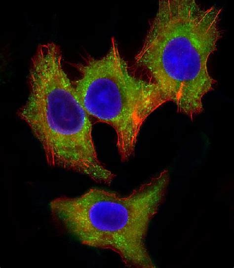 Anti-HCK Antibody | Boster