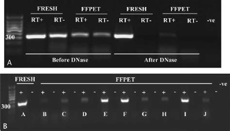 Denaturing gel electrophoresis of DNase-treated RNA isolated from all ...