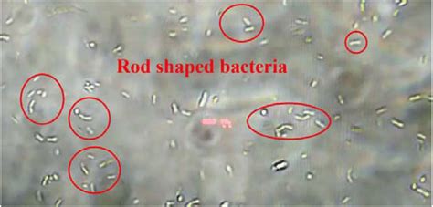 Visualization of bacteria under light microscope | Download Scientific ...