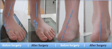 image1 - Perth Podiatric Surgery