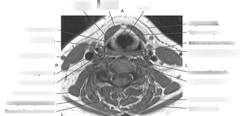 Laryngopharynx Diagram | Quizlet