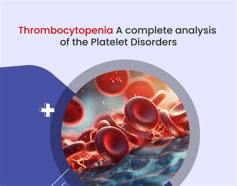 Thrombocytopenia: Symptoms, Stages Treatment, 43% OFF