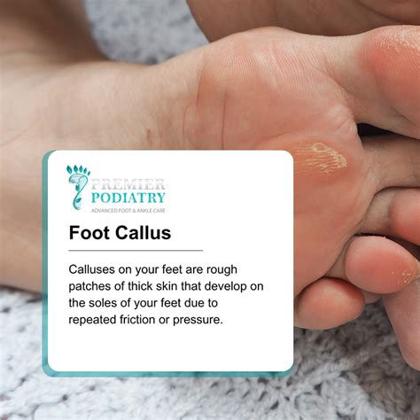 Callus On Toes