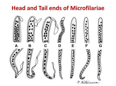 Filarial worms dr. rs 28 08-2017 | PPT