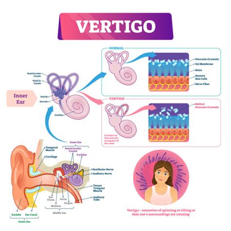 200+ Vertigo Ear Stock Illustrations, Royalty-Free Vector Graphics ...