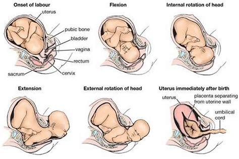 Cephalic presentation of baby in pregnancy