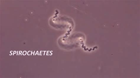 Borrelia Burgdorferi Bacteria Microscope