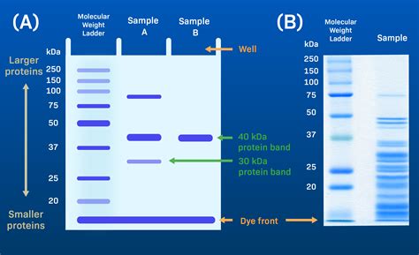 Gel Electrophoresis Diagram Labeled | The Best Porn Website