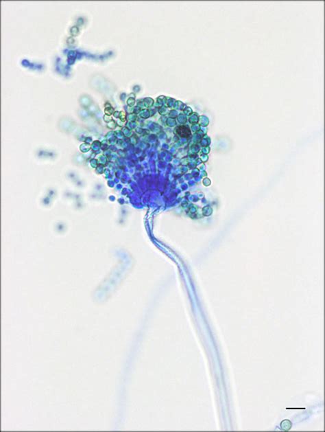 Aspergillus Flavus Under Microscope