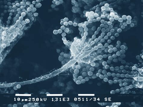 Fungal Spores Can Withstand High Doses of Cosmic Radiation ...