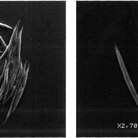 Pure culture of Ankistrodesmus falcatus viewed under a scanning ...