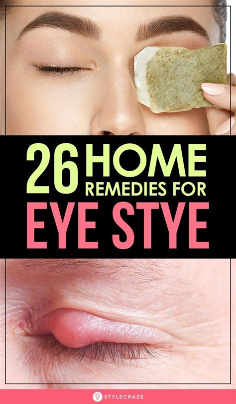 Home Eye Stye Treatment Chalazion Treatment Eyelid