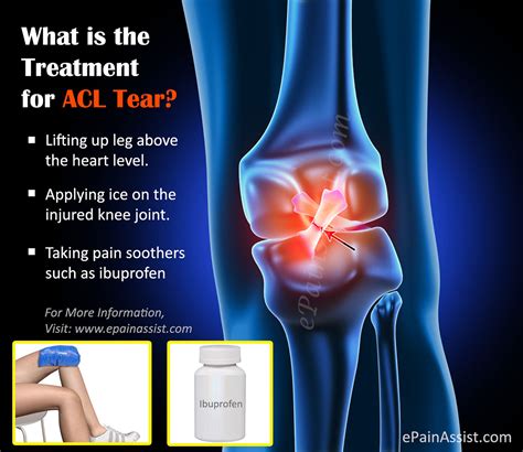 Treatment for ACL Tear|Surgery|Post Operative Rehab|Recovery