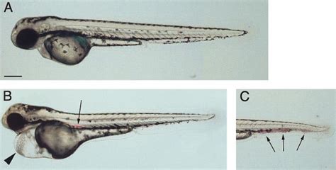 Morphological effects of VEGF-A-1 morpholino injection at 36 h. (A ...