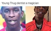 How Did Young Thug Fix His Teeth - TeethWalls