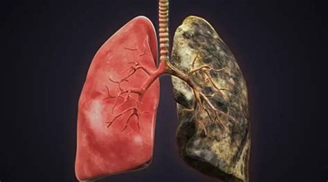 WATCH: Lungs of smokers vs non-smokers; this viral video shows the real ...