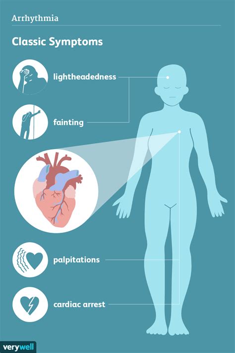 Cardiac Arrhythmias: Signs and Symptoms