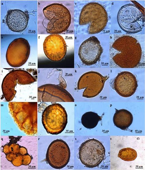 The Benefit of Fungal Spores - microBIOMETER