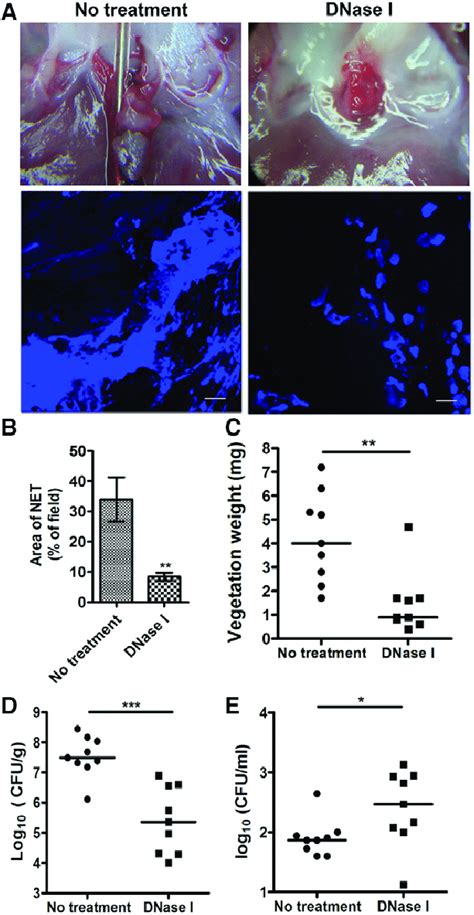 Digestion of NETs by DNase I reduces the bacterial colonization and ...