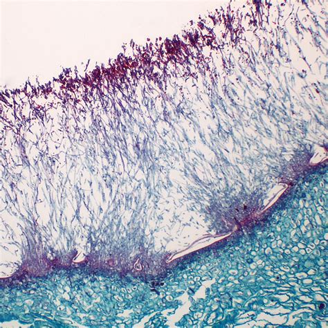 Penicillium, sec., 12 µm Microscope Slide | Carolina.com