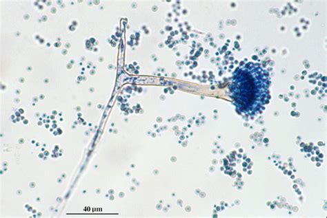 MBBS Medicine (Humanity First): Microscopic morphology of Aspergillus