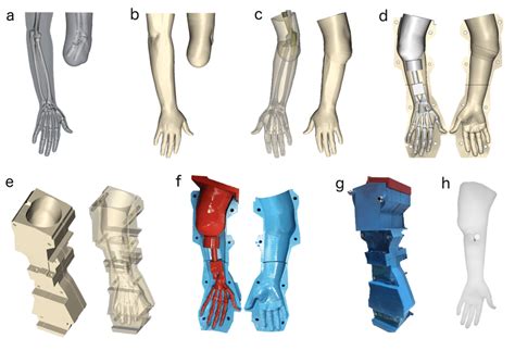 Design and fabrication process for the prosthetic arm. (a) The affected ...